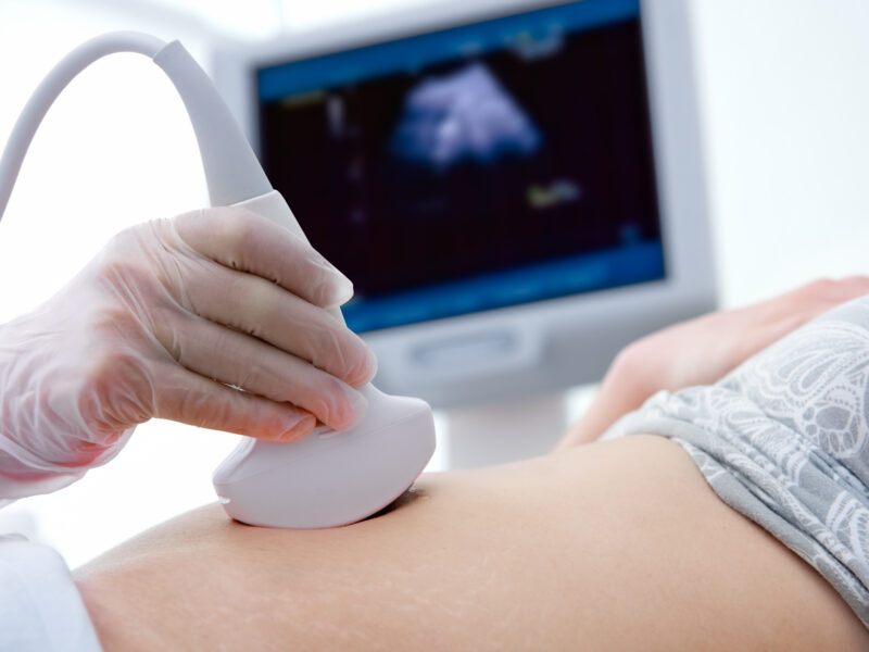 Ein Arzt führt eine Ultraschalluntersuchung am Bauch eines Patienten durch, während ein Monitor im Hintergrund das Ultraschallbild zeigt. Thematisch zeigt es die Sonographie.