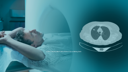 Lungenkrebs-Screening - Fortbildung zur Qualifizierung für die Erstberatung